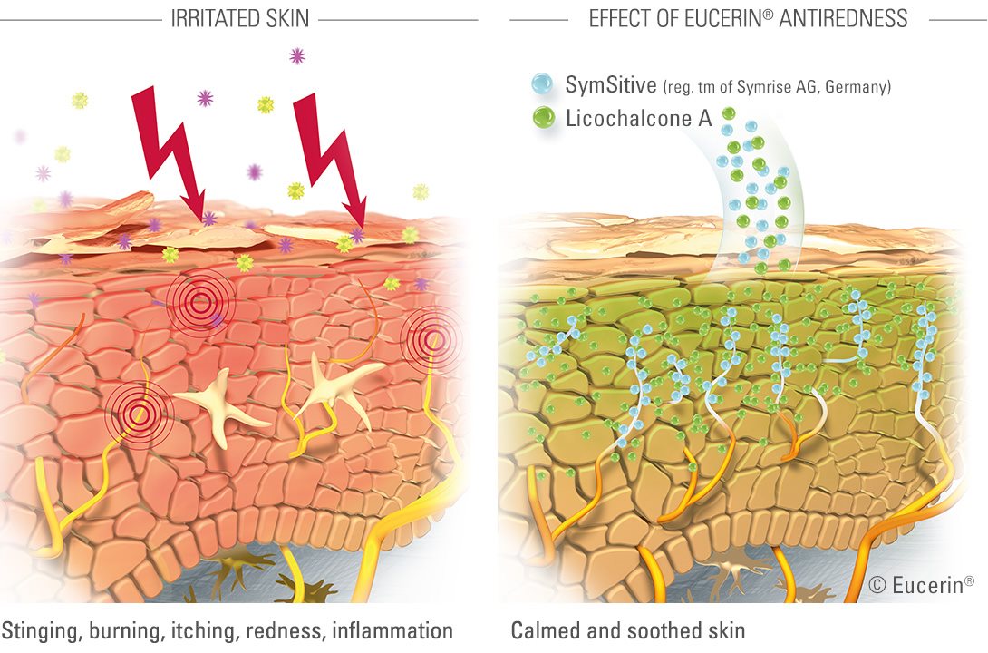 رسم بياني لتوضيح تأثير منتجات Eucerin ANTIREDNESS.