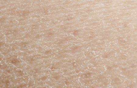 صورة عن قرب لبشرة جافة
