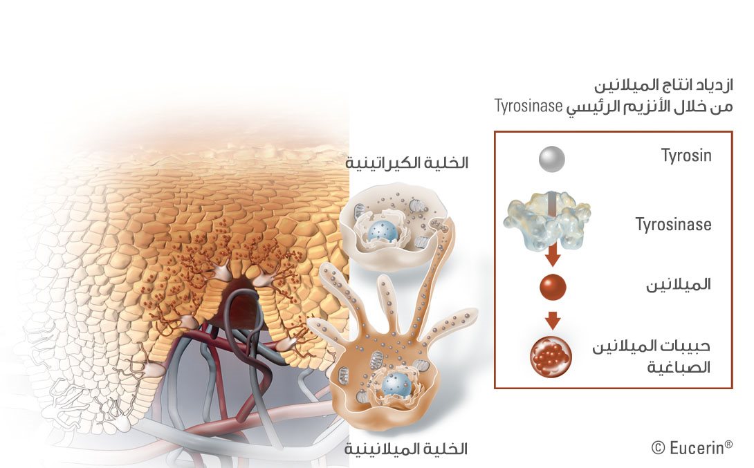 رسم توضيحي لشكل تصبغ البشرة